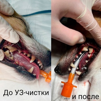 Ультразвуковая чистка зубов в БАРСе