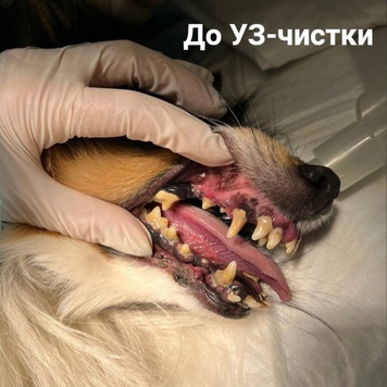 Ультразвуковая чистка зубов в БАРСе