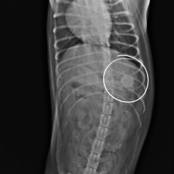Неожиданные находки внутри наших пациентов