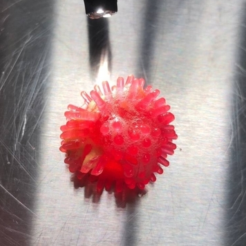 Неожиданные находки внутри наших пациентов