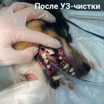 Ультразвуковая чистка зубов в БАРСе
