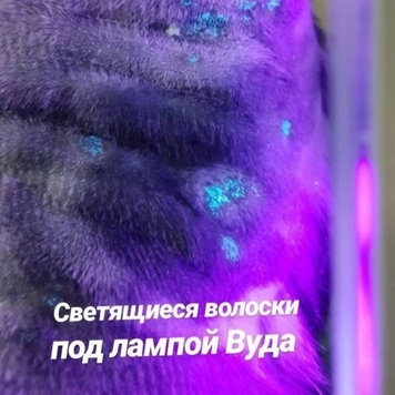 Вопрос дерматологу: ЛИШАЙ