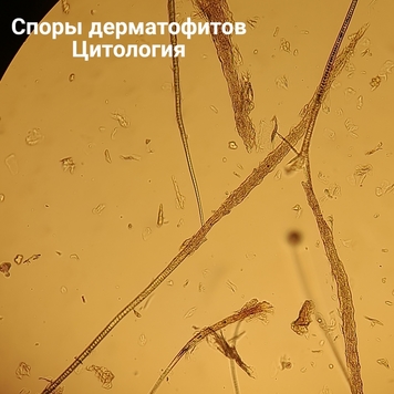 Вопрос дерматологу: ЛИШАЙ