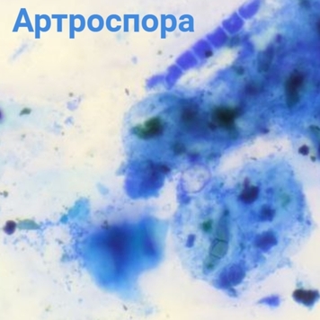 Вопрос дерматологу: ЛИШАЙ